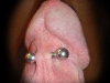 frenum-piercing