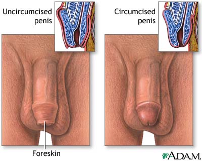 It has more to do with your flaccid penis Having no skin over the head
